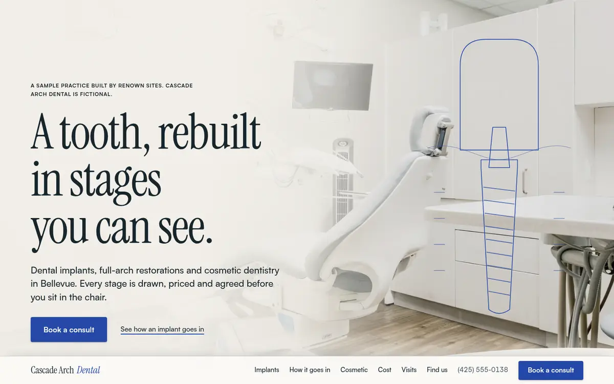 Cascade Arch Dental sample site: a line drawing of an implant beside a book a consult button